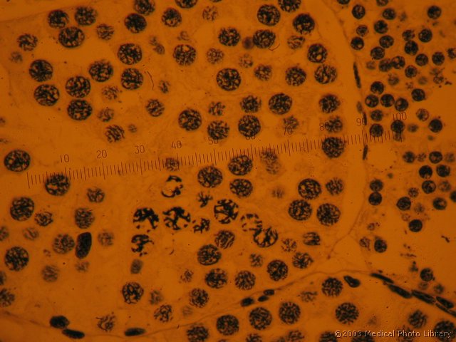 09 Mejoza, testis pupka.jpg