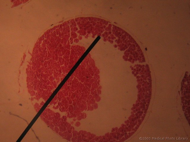 20 Blastula, aksotel, HE.jpg