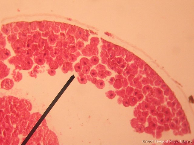 21 Blastula, aksotel, HE.jpg