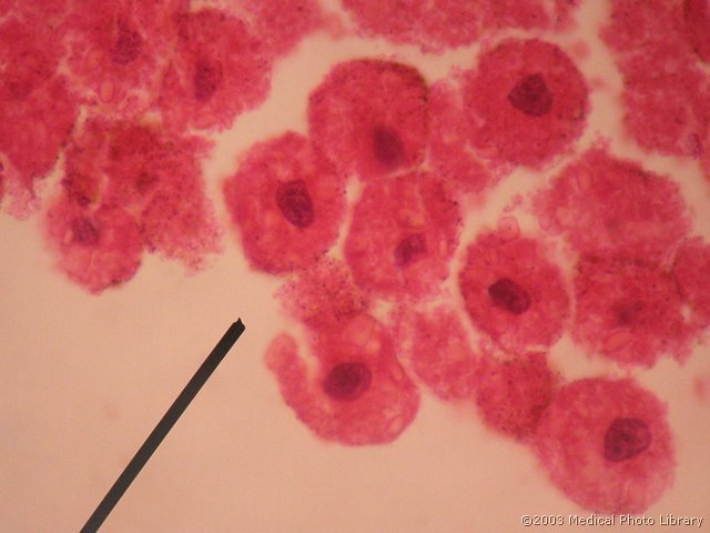 22 Blastula, aksotel, HE.jpg