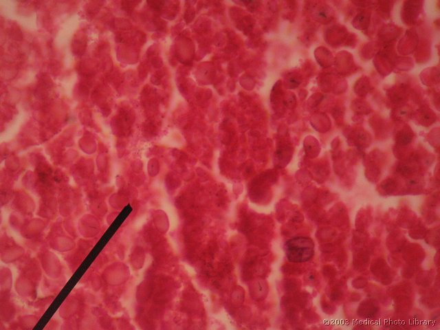 23 Blastula, aksotel, HE.jpg