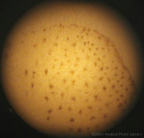 13 - Riba, pigmentne celice(m).jpg