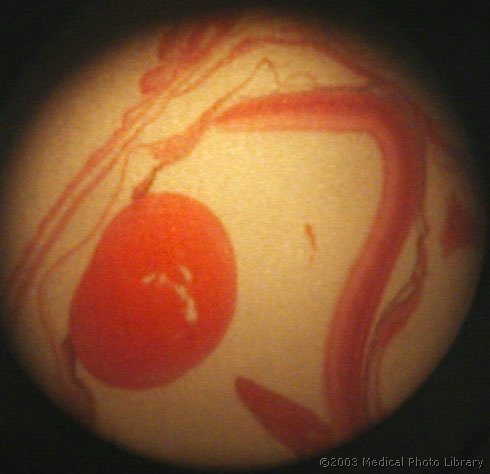 27 - Retina(m).jpg