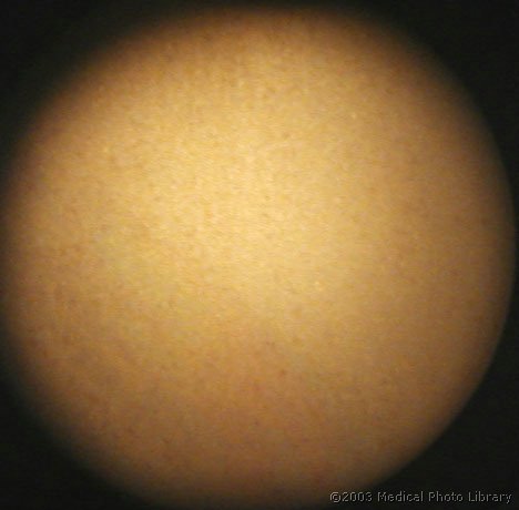 28 - Fibroblasti(m).jpg