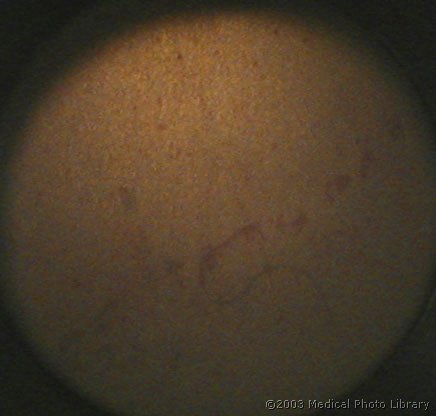 31 - Cloveski kromosomi(m).jpg