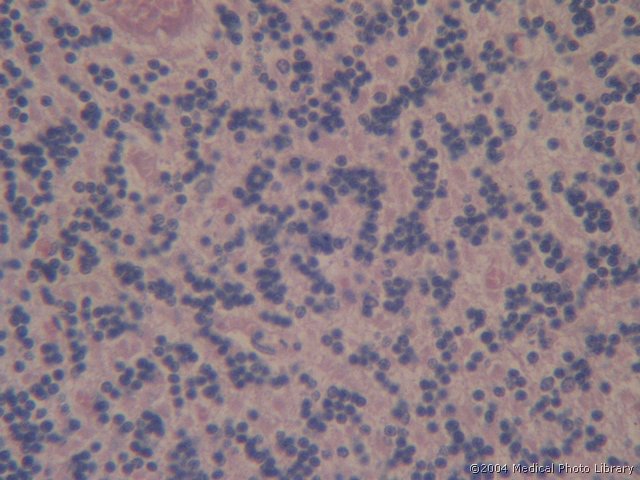 052 07 Zrnata plast.jpg