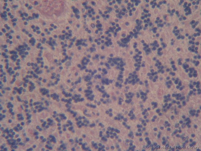 052 08 Zrnata plast.jpg