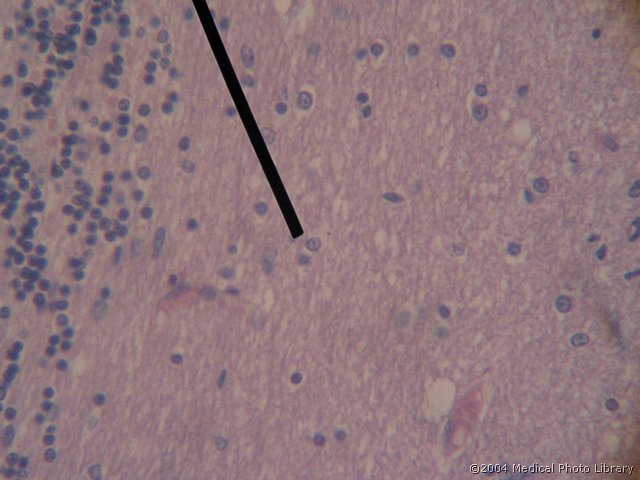 052 10 Astrocit.jpg