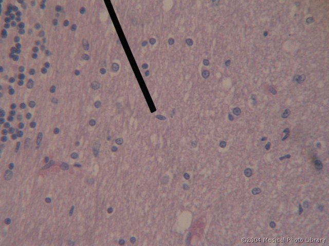 052 11 Mikroglija.jpg