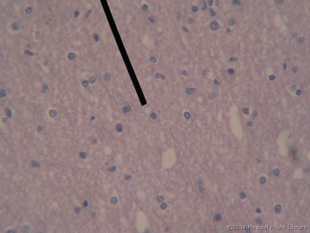 052 12 Oligodendocit.jpg