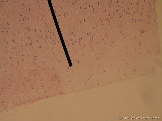 053 03 Molekularna plast.jpg