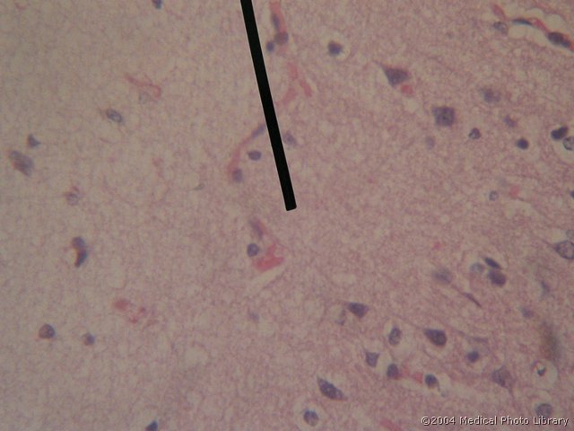 053 06 Zunanja zrnata.jpg