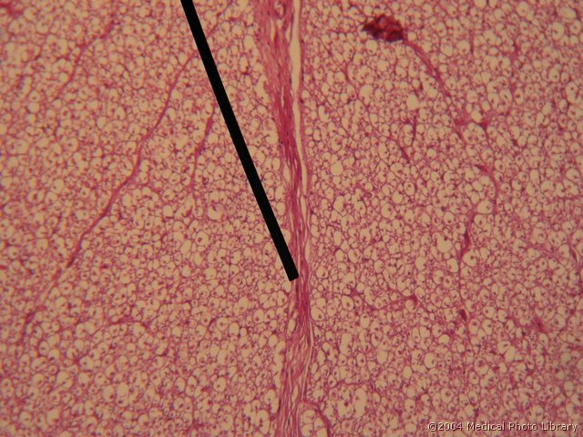 148 11 Fissura mediana.jpg