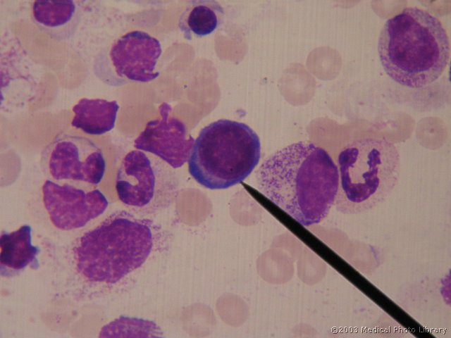 D000 02 Bazofilni eritroblast.jpg