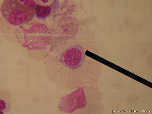 D000 03 Polikromaticni eritroblast.jpg