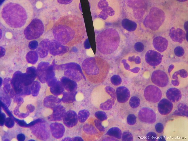 D000 08 Eozinofilni mielocit.jpg