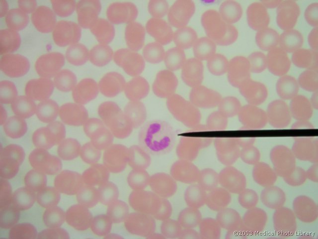 D000 10 Palicasti nevtrofilni granulocit.JPG