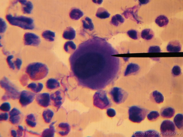 D000 11 Megakarioblast.jpg