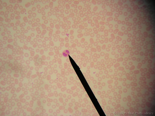D000 16 Eozinofilni granulocit.JPG