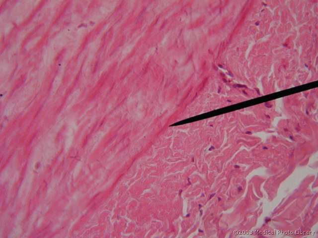 056 5 Membrana elastica externa.jpg