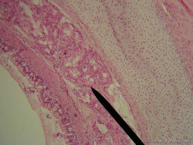 025 03 Vezivna propria  z zlezami.JPG