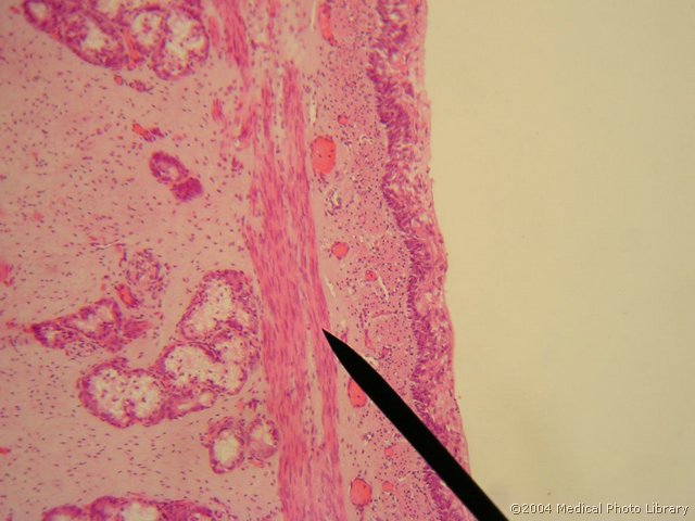 025 04 Misicna vlakna.JPG