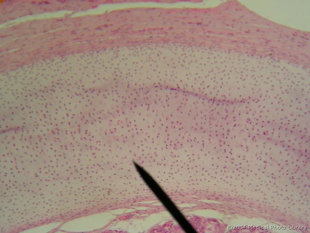 025 05 Hrustancevina.JPG