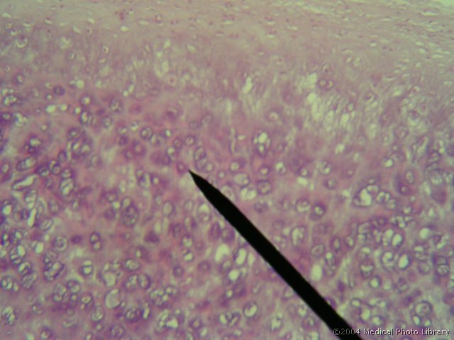 026 03 Hrustancevina.JPG