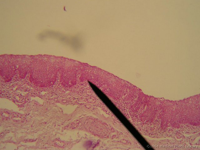 026 05 Papile (lingvalni del).JPG