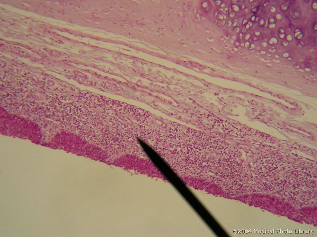 026 06 Lamina propria z limfociti.JPG