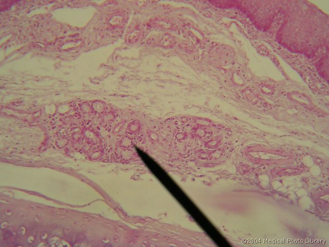 026 07 Zleze na lingvalnem delu.JPG