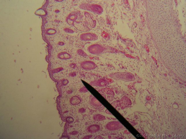 038 04 Dlacni mesicki.JPG