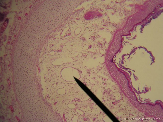 038 05 Zile- venski sistem.JPG