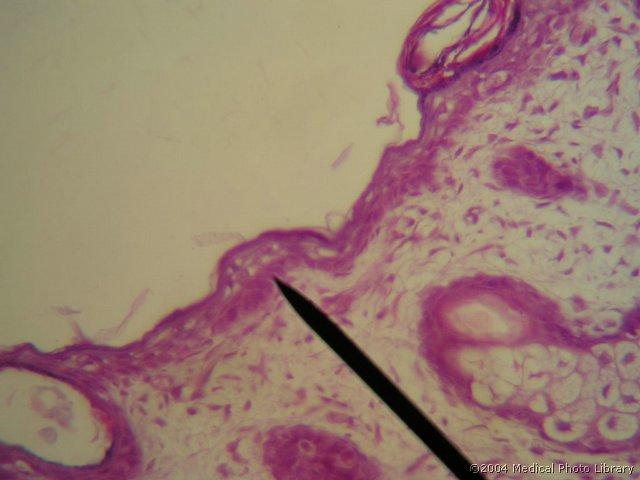 038 06 Respiratorni epitelij.JPG