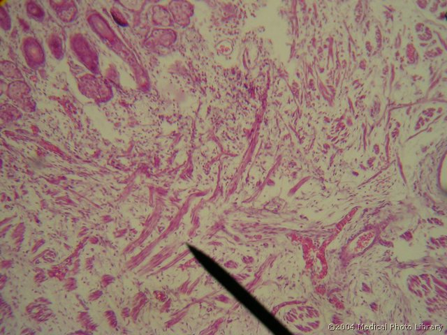 038 07 Misicna vlakna.JPG