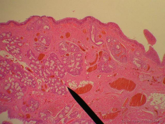 108 01 Lazna glasilka.JPG