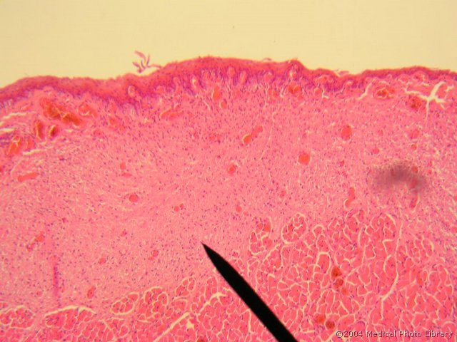 108 04 Ligament vocalis.JPG