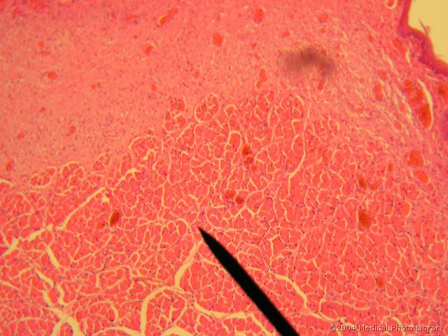 108 05 Musculus vocalis.JPG