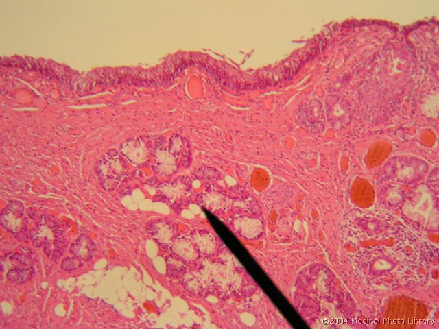 108 07 Zleze v lazni glasilki.JPG