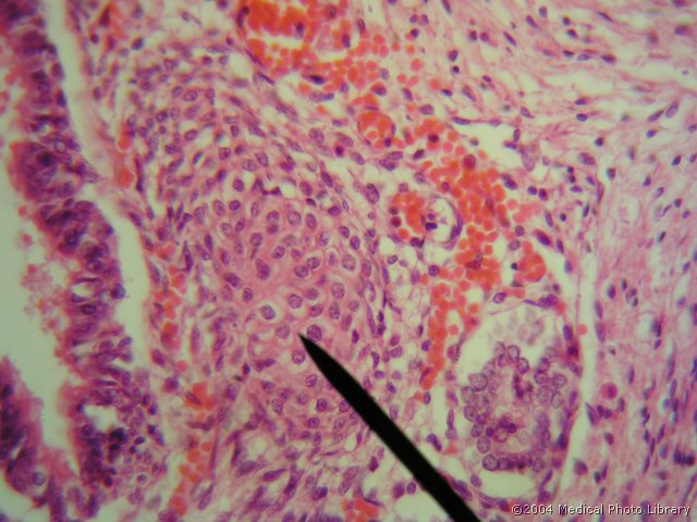 109 03 Mlada hialina hrustancevina.JPG