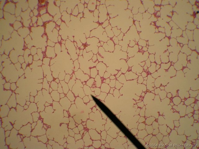 110 02 Respiratorni del.JPG