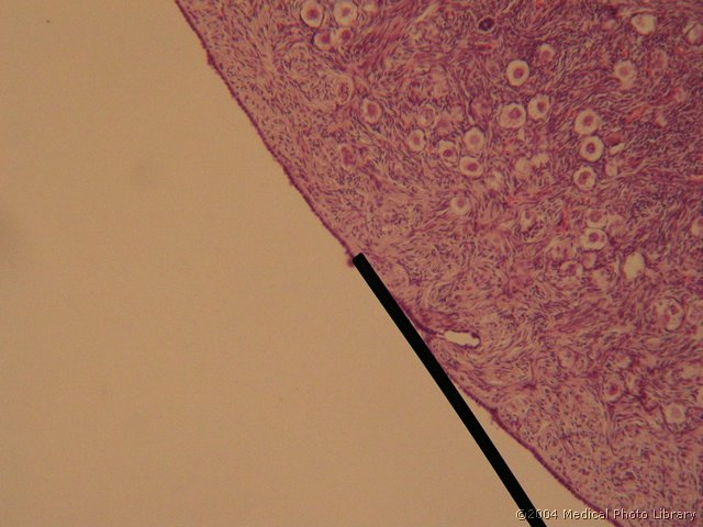 011 03 Klicni epitelij.jpg