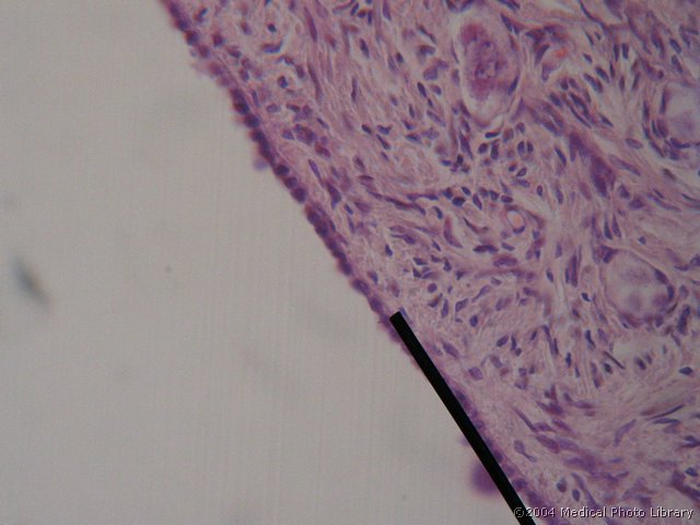 011 04 Klicni epitelij.jpg