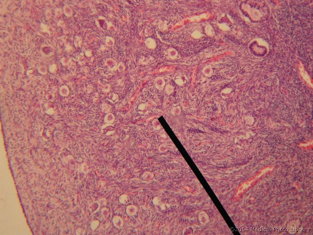 011 05 Parenhimska c.jpg