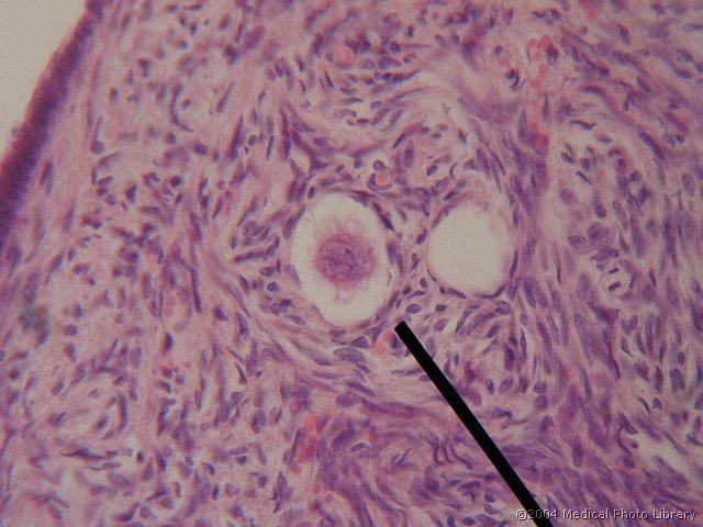 011 06 Primordialni f.jpg