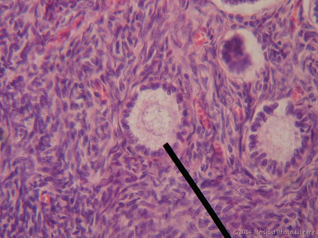 011 07 Primarni f.jpg