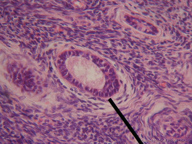 011 08 Multilamenarni p f.jpg