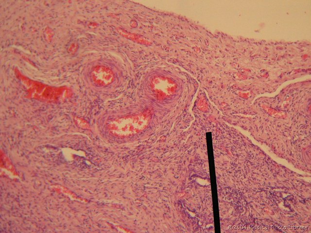 011 09 Vaskulozna c.jpg