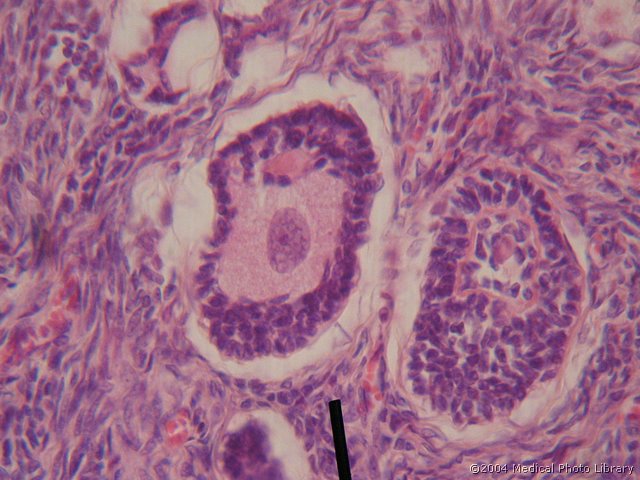 011 10 Sekundarni f.jpg