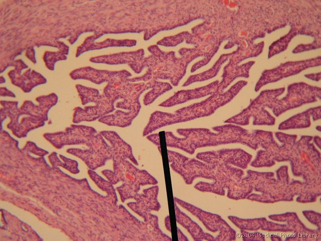 011 11 Tuba uterina.jpg